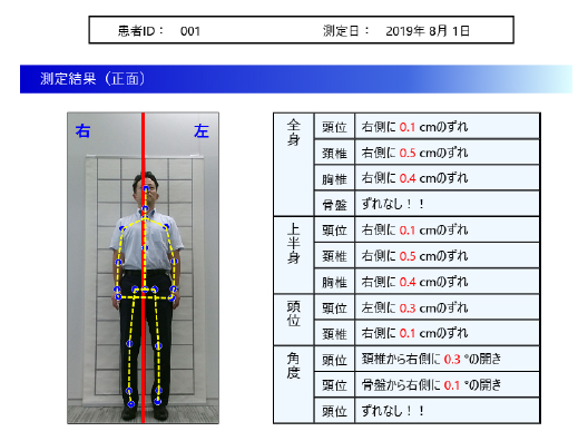 歯科用立ち姿勢判別システム | 商品詳細_仕様 | 株式会社ヨシダ